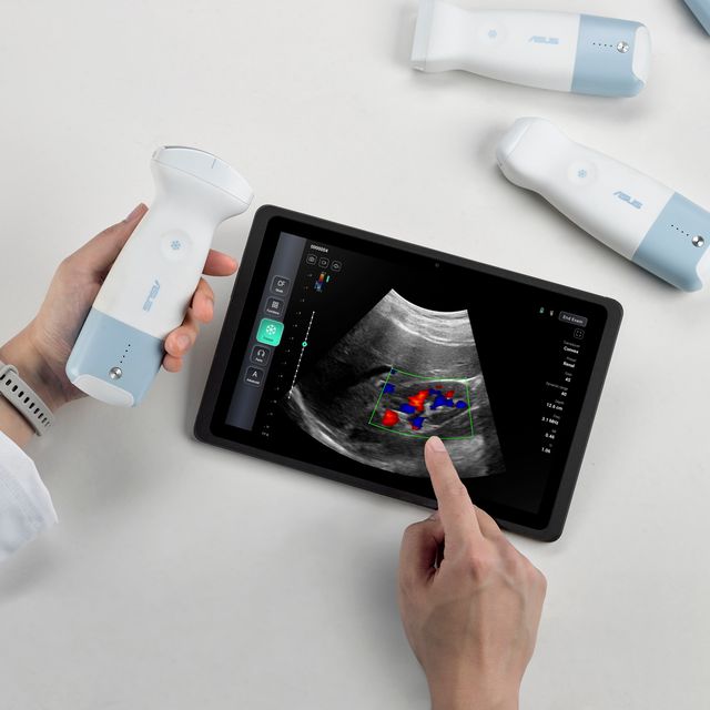 Asus Handheld Ultrasound L U800 Scenario